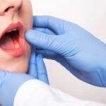 Before It Becomes Oral Cancer in Ahmedabad: Precancerous Conditions You Shouldn't Ignore
